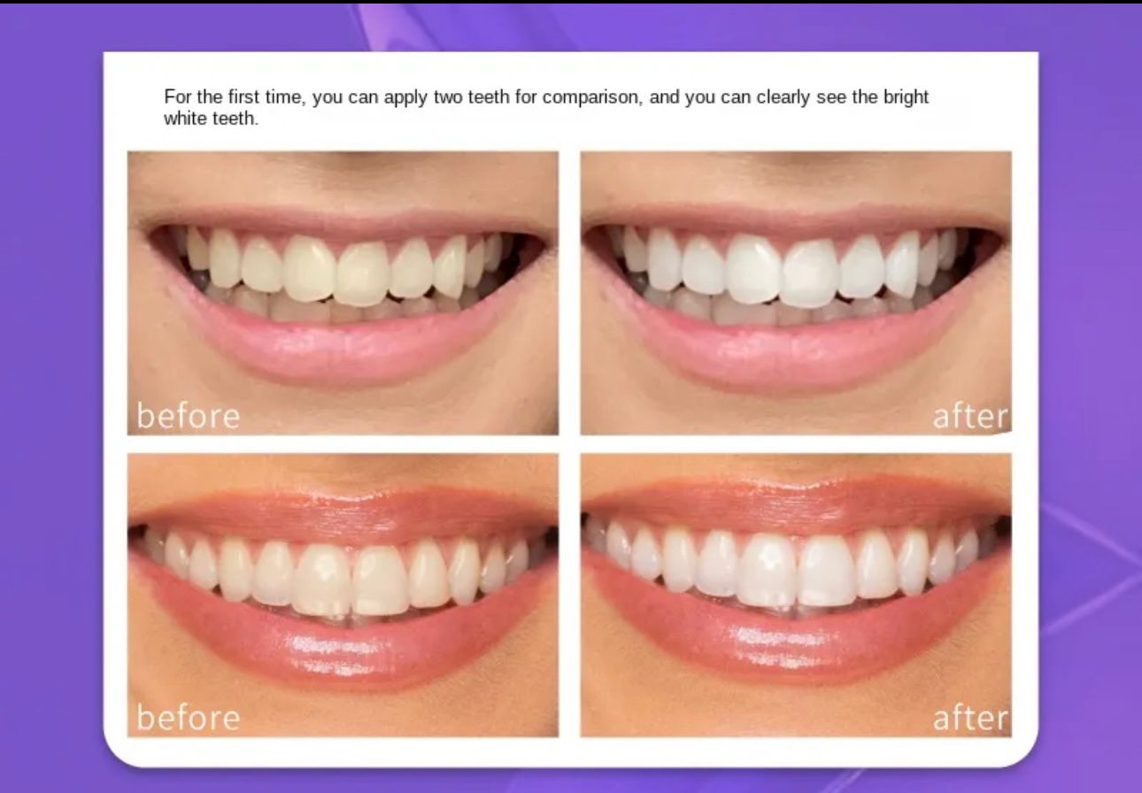 Teeth brightening hismiles V34 Colour Corrector Serum 30ml